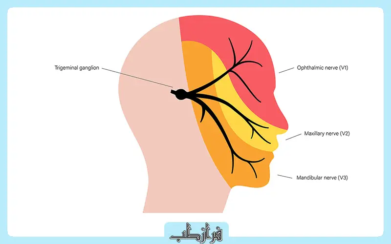 علائم میگرن عصبی چیست و کدام سردرد اورژانسی است؟ 1 علائم میگرن عصبی چیست؟