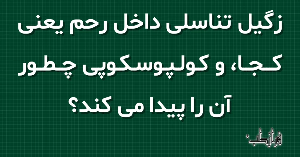 زگیل تناسلی داخل رحم یعنی کجا، و کولپوسکوپی چطور آن را پیدا می کند؟